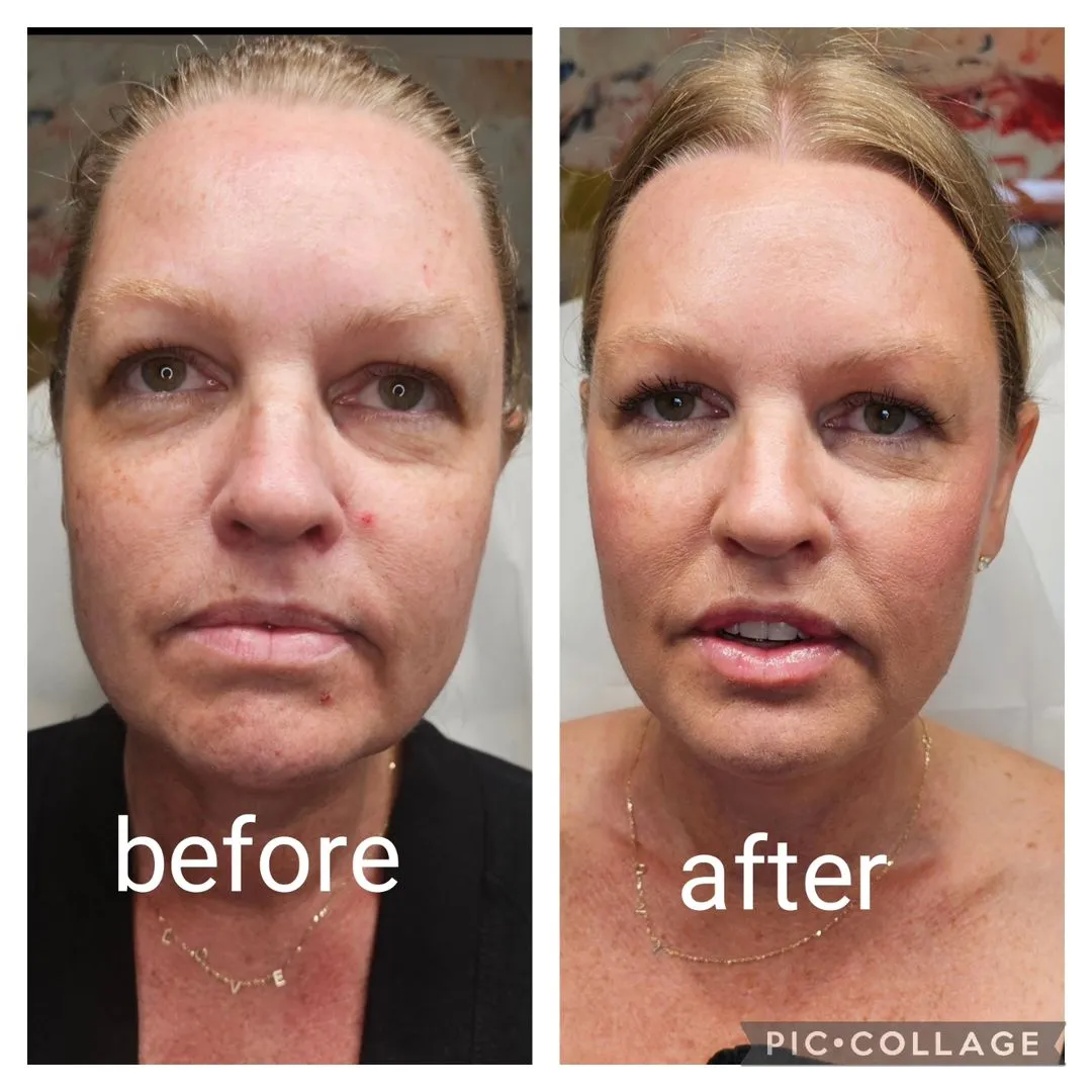 full face SkinVive