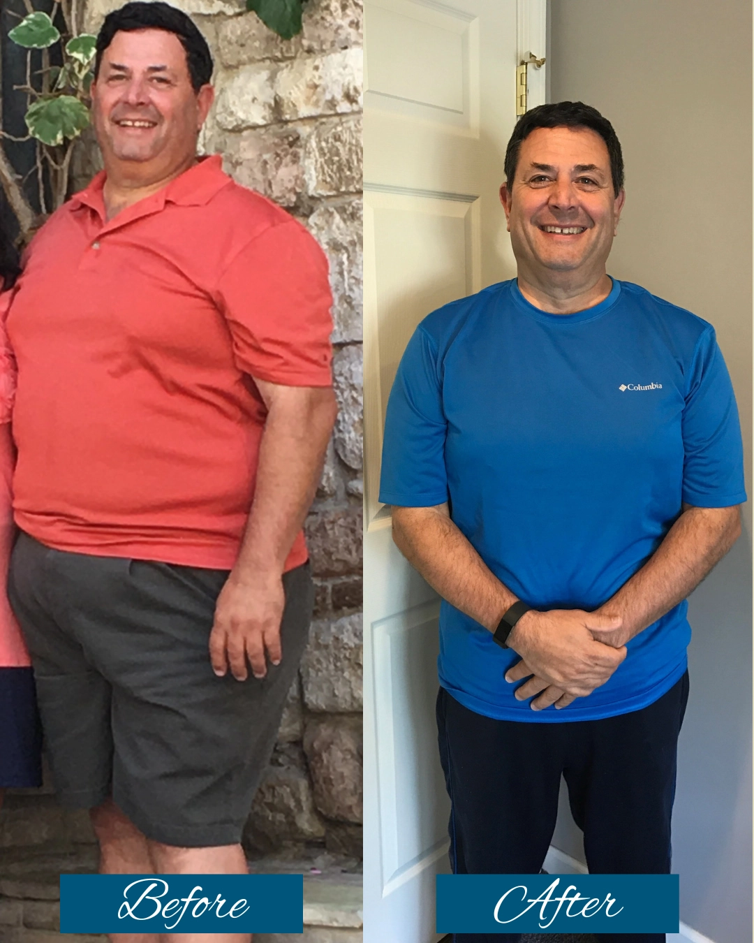 medical weight loss case 2