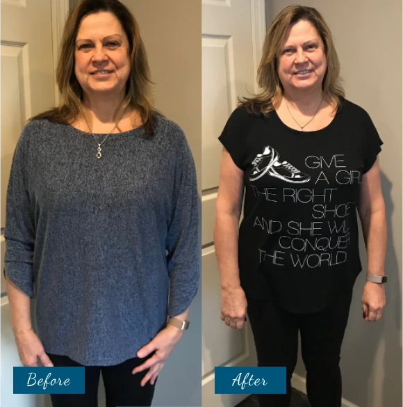 Weight Loss Before & After Banner