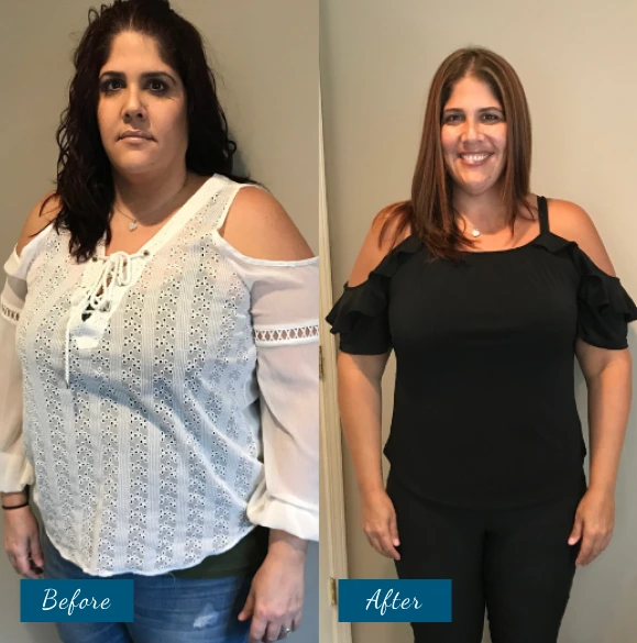 Weight Loss Before & After Banner