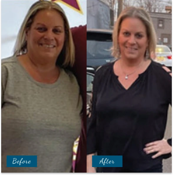 Weight Loss Before & After Banner