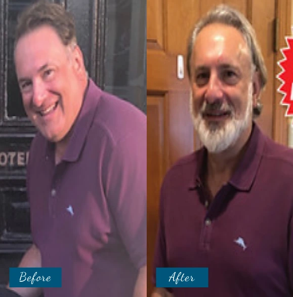 Weight Loss Before & After Banner