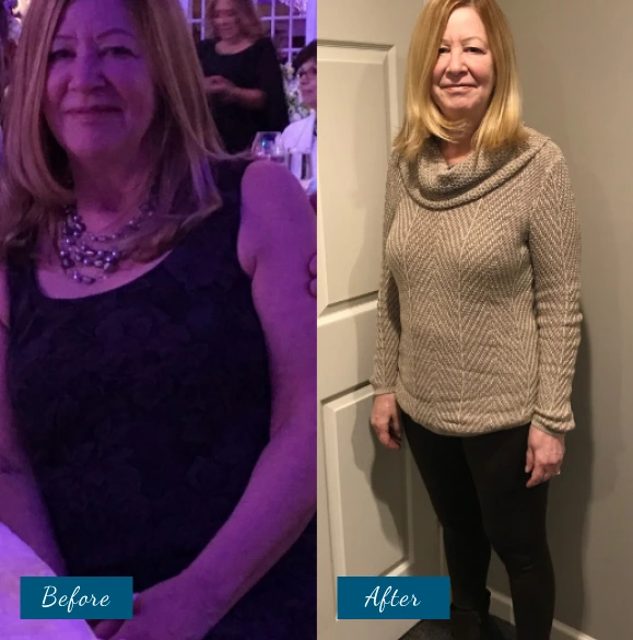 Weight Loss Before & After Banner