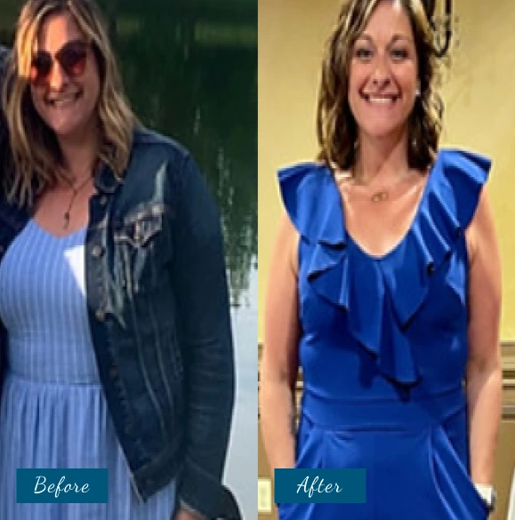 Weight Loss Before & After Banner