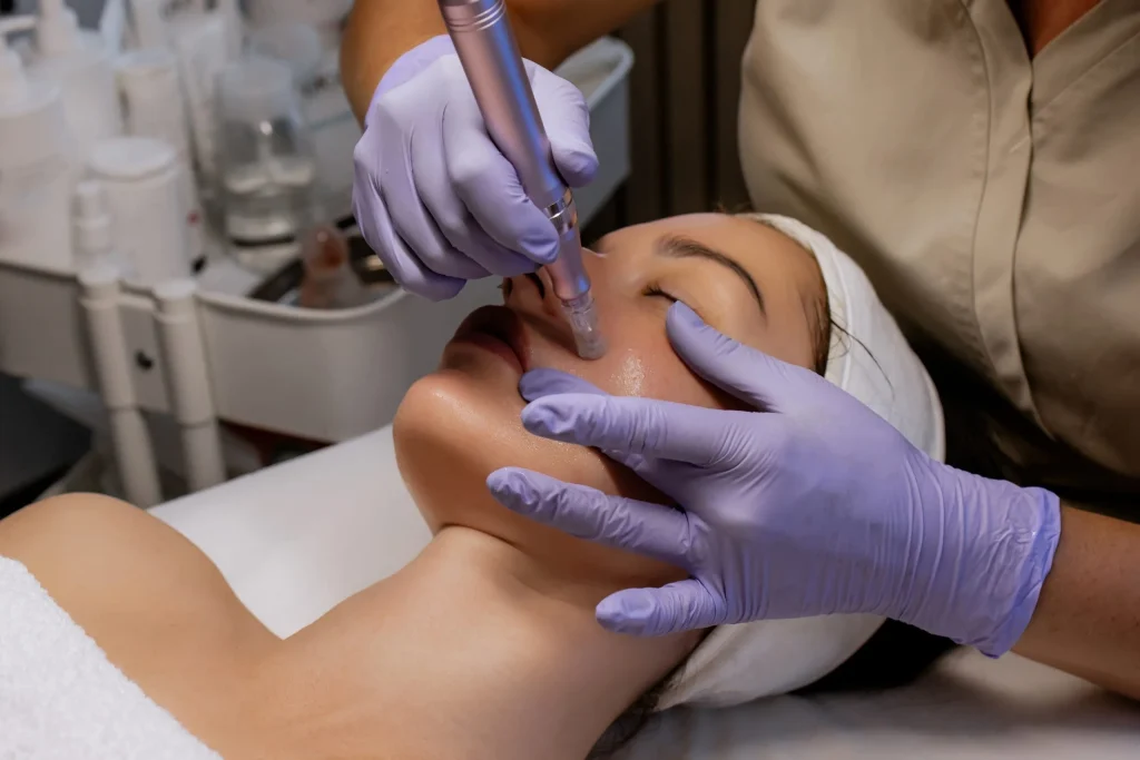 How Long Do Microneedling Results Last? What You Can Expect Banner